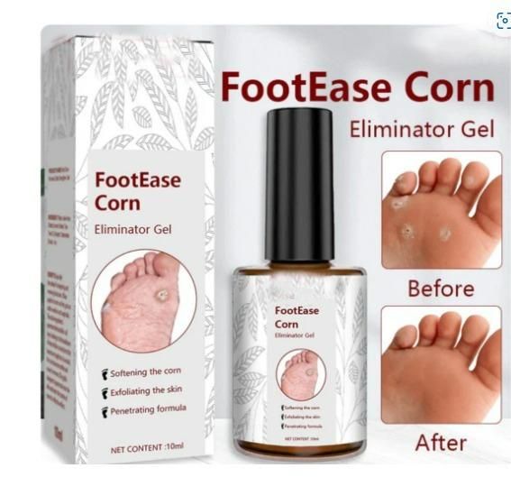 Feet Corn Removal Serum 30ml